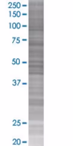 Astn2 293t cell transient overexpre ssion lysate (denatured) 100 µl