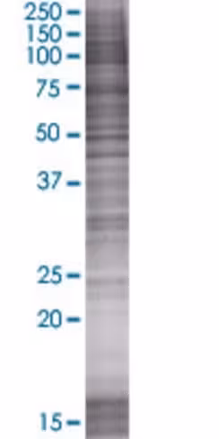 Asciz 293t cell transient overexpre ssion lysate (denatured) 100 µl