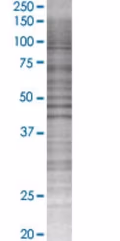 Phf15 293t cell transient overexpre ssion lysate (denatured) 100 µl