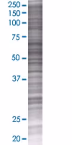 Psd3 293t cell transient overexpres sion lysate (denatured) 100 µl