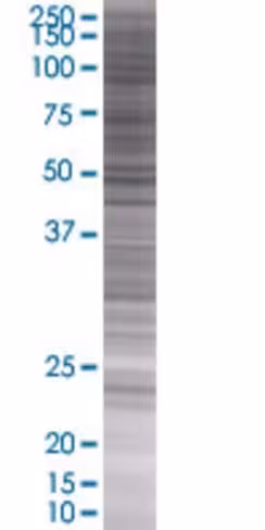Pip5k1c 293t cell transient overexp ression lysate (denatured) 100 µl