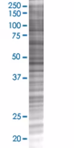 Pip5k1c 293t cell transient overexp ression lysate (denatured) 100 µl