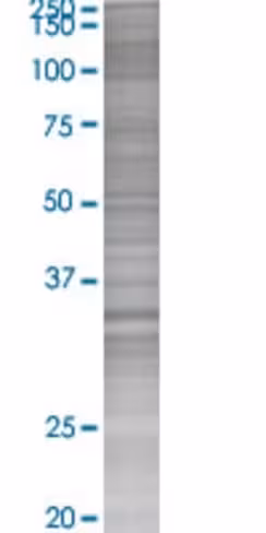 Qprt 293t cell transient overexpres sion lysate (denatured) 100 µl