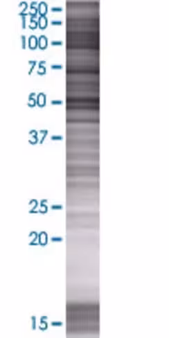 Prame 293t cell transient overexpre ssion lysate (denatured) 100 µl