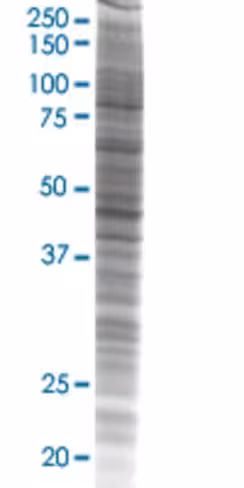 Rbm9 293t cell transient overexpres sion lysate (denatured) 100 µl