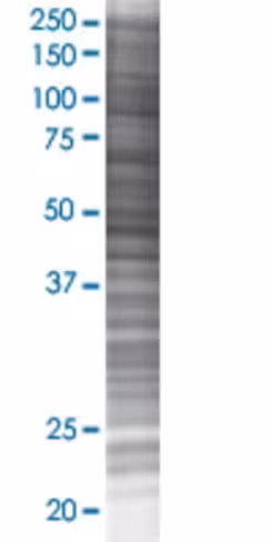 Orc3l 293t cell transient overexpre ssion lysate (denatured) 100 µl