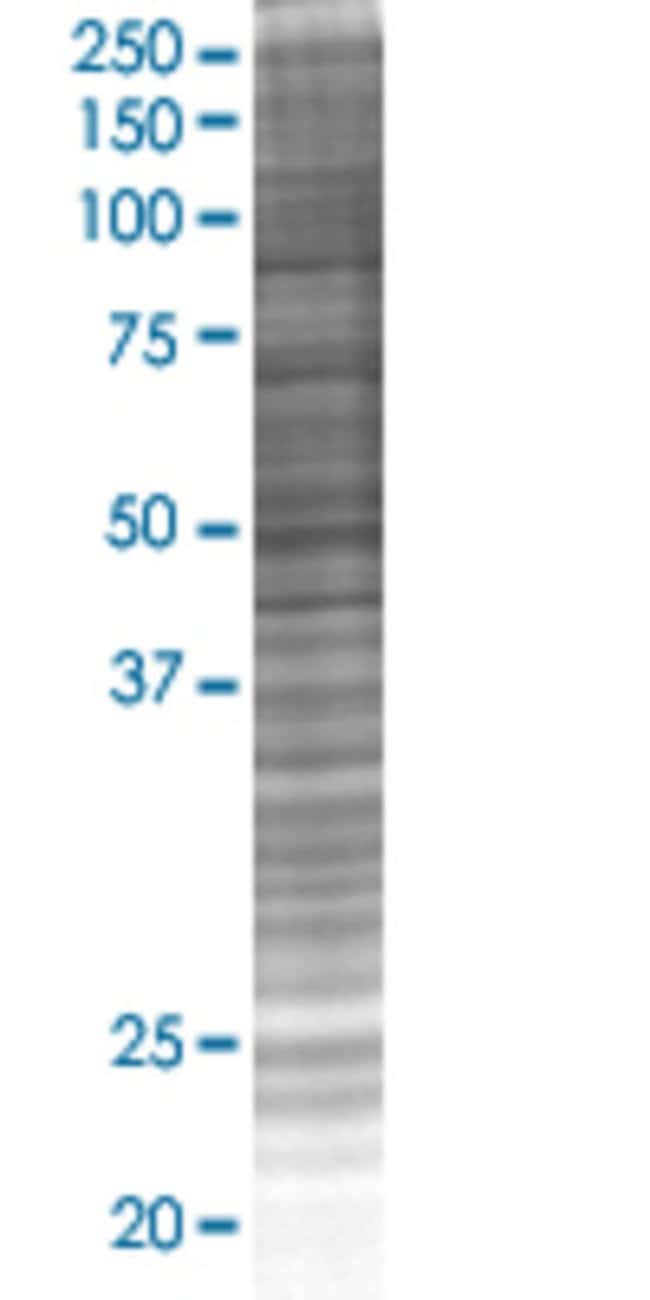 Pgea1 293t cell transient overexpre ssion lysate (denatured) 100 µl