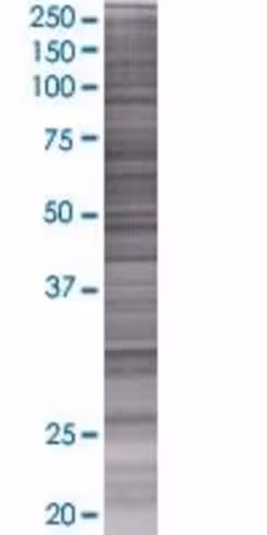 Pgls 293t cell transient overexpres sion lysate (denatured) 100 µl