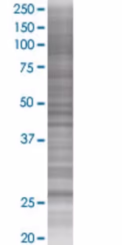 Pgls 293t cell transient overexpres sion lysate (denatured) 100 µl