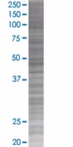 Qpct 293t cell transient overexpres sion lysate (denatured) 100 µl