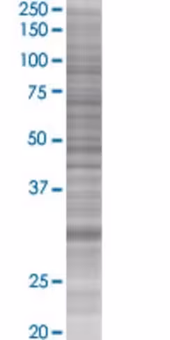 Qpct 293t cell transient overexpres sion lysate (denatured) 100 µl