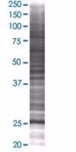 Rab26 293t cell transient overexpre ssion lysate (denatured) 100 µl