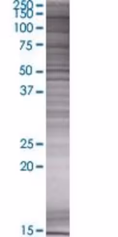 Plekhg4 293t cell transient overexp ression lysate (denatured) 100 µl