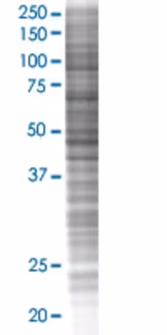Rchy1 293t cell transient overexpre ssion lysate (denatured) 100 µl