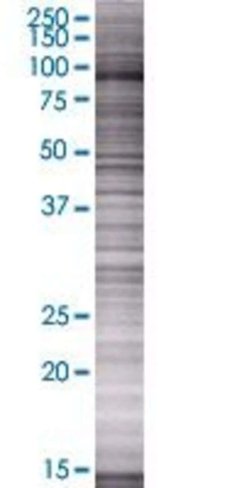 Osbpl3 293t cell transient overexpr ession lysate (denatured) 100 µl