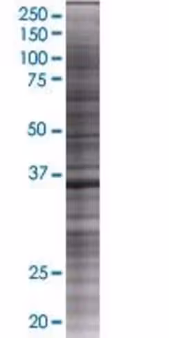Plek2 293t cell transient overexpre ssion lysate (denatured) 100 µl