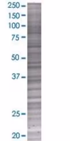 Pcolce2 293t cell transient overexp ression lysate (denatured) 100 µl