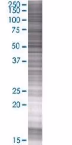 Ranbp6 293t cell transient overexpr ession lysate (denatured) 100 µl