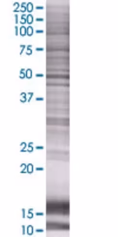 Pde7b 293t cell transient overexpre ssion lysate (denatured) 100 µl