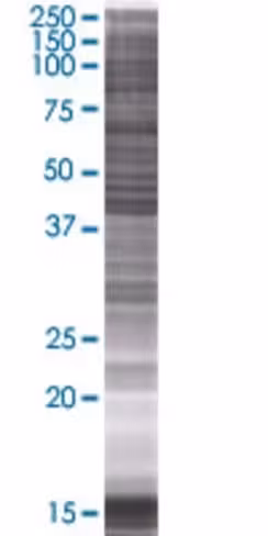Pscd4 293t cell transient overexpre ssion lysate (denatured) 100 µl