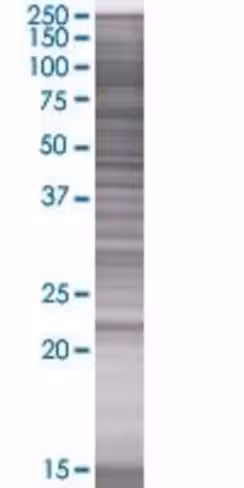 Pgds 293t cell transient overexpres sion lysate (denatured) 100 µl