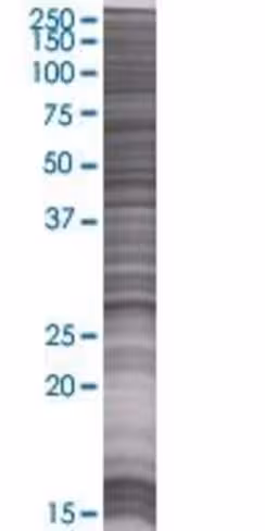 Pcsk1n 293t cell transient overexpr ession lysate (denatured) 100 µl