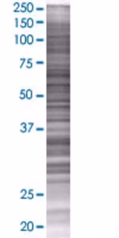 Rem1 293t cell transient overexpres sion lysate (denatured) 100 µl