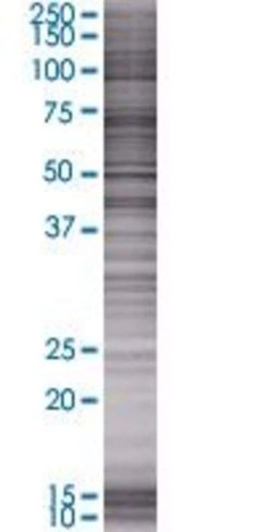 Atad2 293t cell transient overexpre ssion lysate (denatured) 100 µl