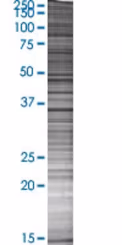 Pycr2 293t cell transient overexpre ssion lysate (denatured) 100 µl