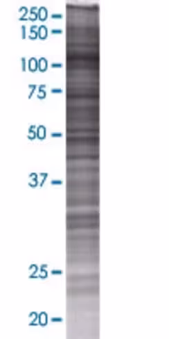Pkn3 293t cell transient overexpres sion lysate (denatured) 100 µl