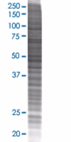 Pkn3 293t cell transient overexpres sion lysate (denatured) 100 µl