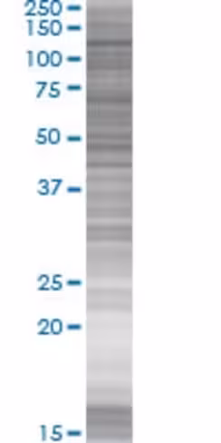 Pdzrn4 293t cell transient overexpr ession lysate (denatured) 100 µl