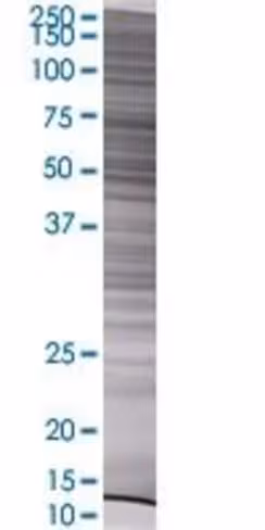 Pacsin1 293t cell transient overexp ression lysate (denatured) 100 µl