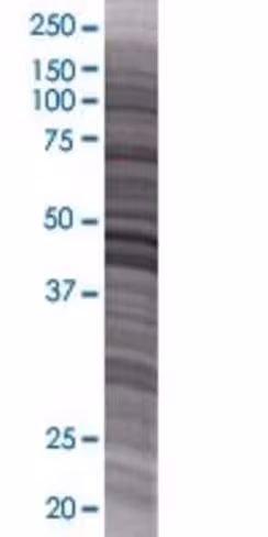 Pla2g2e 293t cell transient overexp ression lysate (denatured) 100 µl