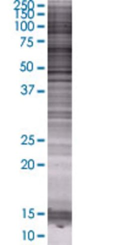 Pla2g3 293t cell transient overexpr ession lysate (denatured) 100 µl