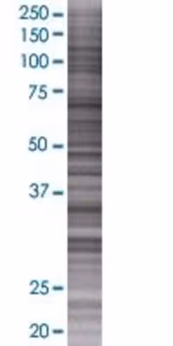 Rdh8 293t cell transient overexpres sion lysate (denatured) 100 µl