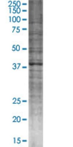 Pard6a 293t cell transient overexpr ession lysate (denatured) 100 µl
