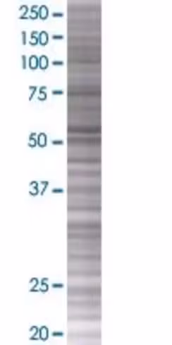 Plekho1 293t cell transient overexp ression lysate (denatured) 100 µl
