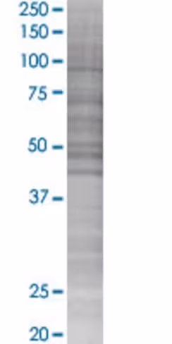 Nusap1 293t cell transient overexpr ession lysate (denatured) 100 µl