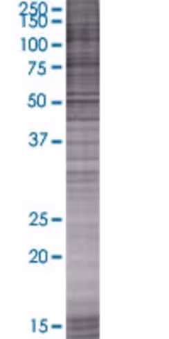 Pla1a 293t cell transient overexpre ssion lysate (denatured) 100 µl