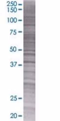 Ppme1 293t cell transient overexpre ssion lysate (denatured) 100 µl