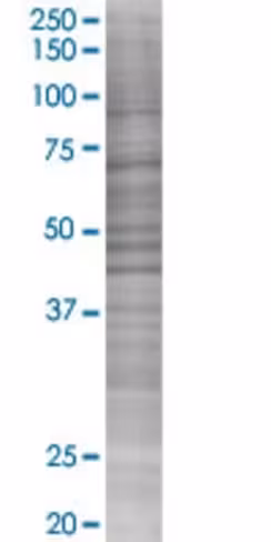 Prkag2 293t cell transient overexpr ession lysate (denatured) 100 µl