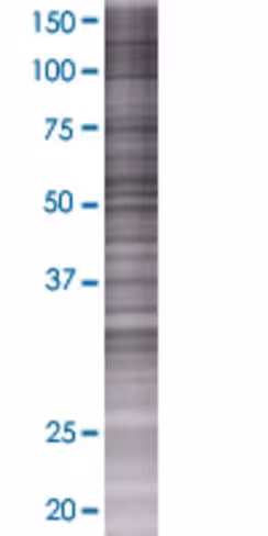 Polk 293t cell transient overexpres sion lysate (denatured) 100 µl