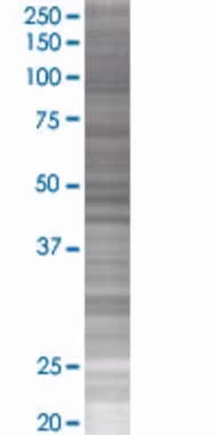 Prrx2 293t cell transient overexpre ssion lysate (denatured) 100 µl