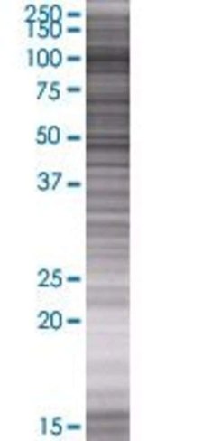 Ars2 293t cell transient overexpres sion lysate (denatured) 100 µl
