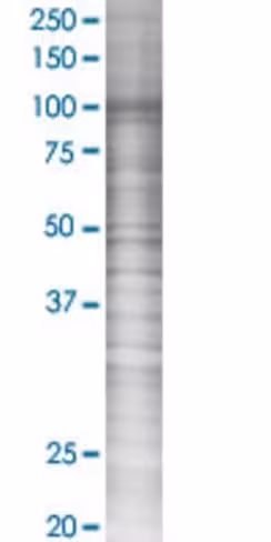 Ars2 293t cell transient overexpres sion lysate (denatured) 100 µl