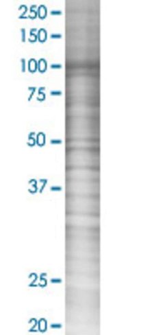 Ars2 293t cell transient overexpres sion lysate (denatured) 100 µl