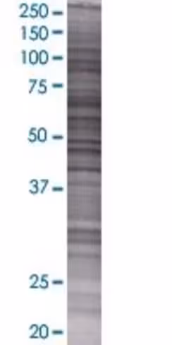 Ptrh2 293t cell transient overexpre ssion lysate (denatured) 100 µl