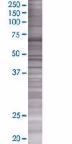 Padi3 293t cell transient overexpre ssion lysate (denatured) 100 µl