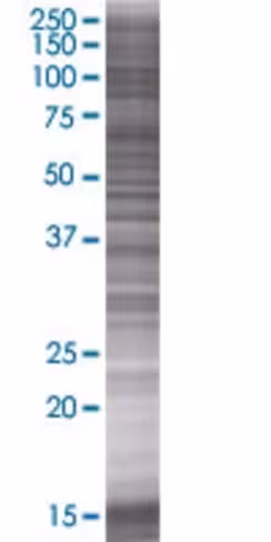 Pank1 293t cell transient overexpre ssion lysate (denatured) 100 µl
